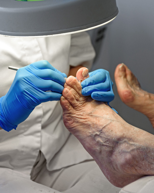 Foot Care